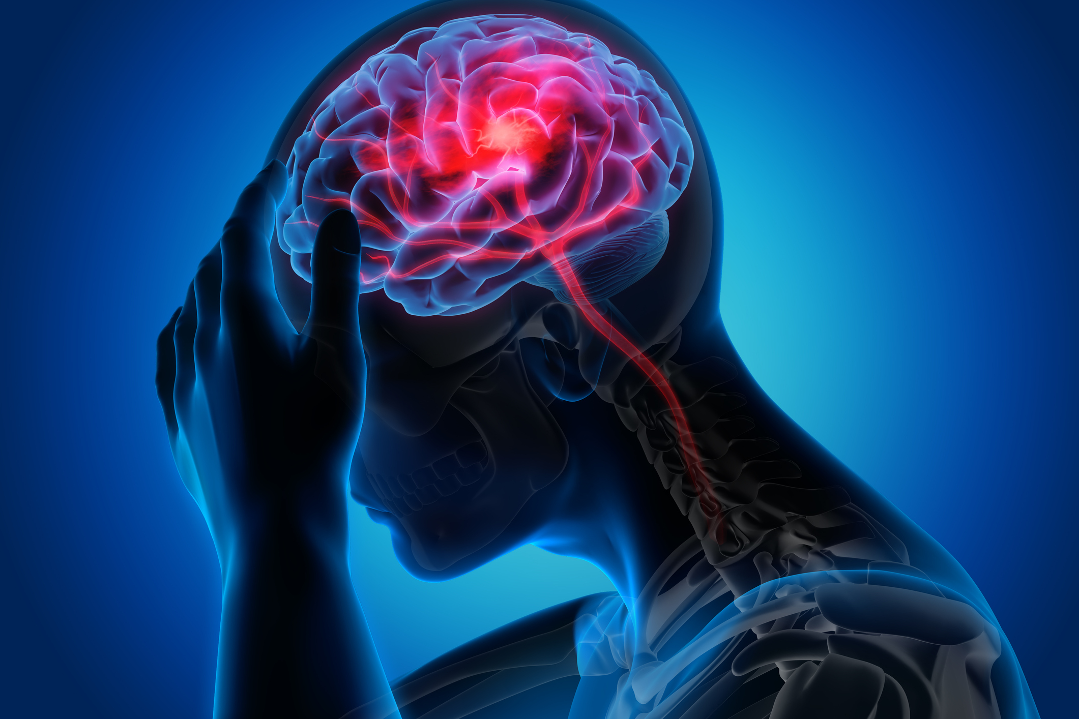 Types Of Seizures Neurology Center For Epilepsy Seizures